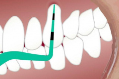 dental-3599725_640